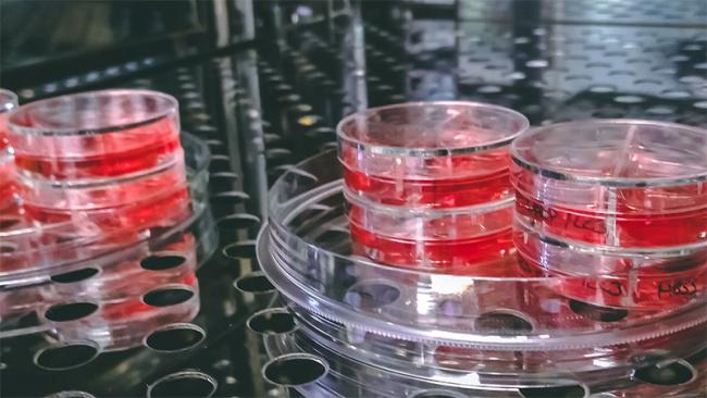 Petri dishes in laboratory